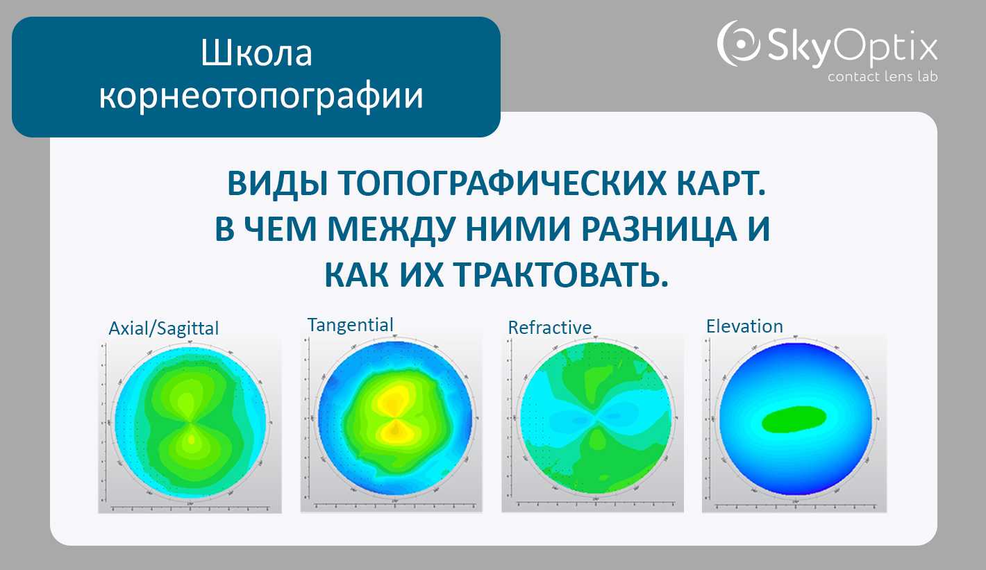 Виды топографических карт. В чем между ними разница и как их трактовать. -  SkyOptix